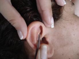 AU aplicando ag auricular.JPG